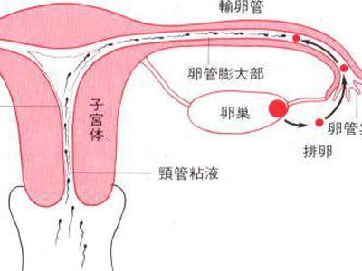 输卵管粘连能否自然受孕？怎么治？